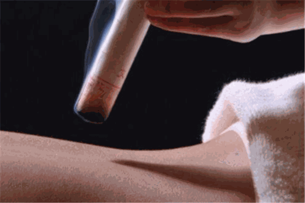 董敏园艾灸培训